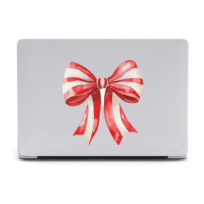 Jingle Bows