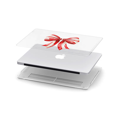 Jingle Bows